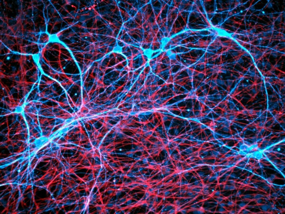 Нейронные микросети