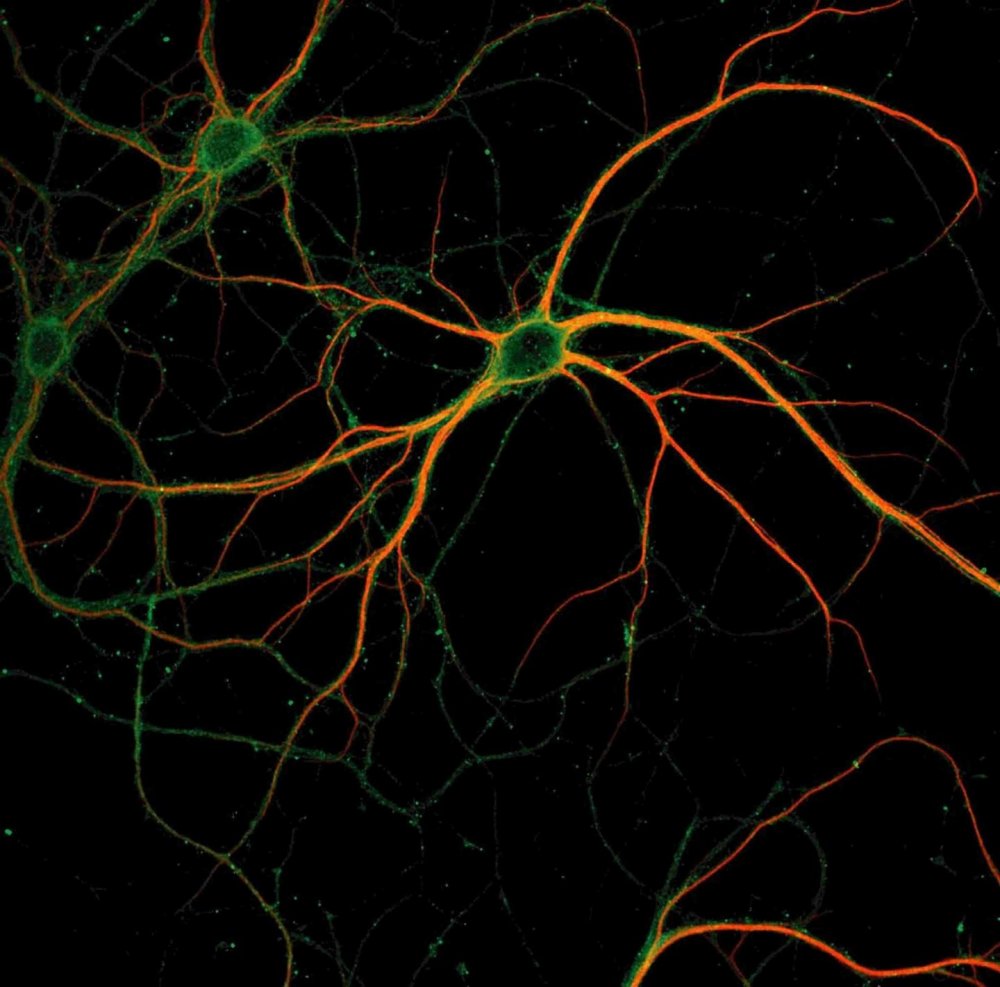 Мозг нейронные связи
