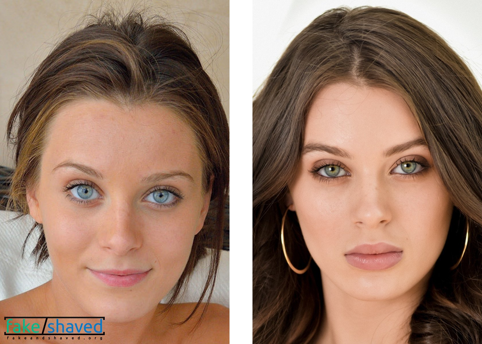 Lana rhoades before surgery