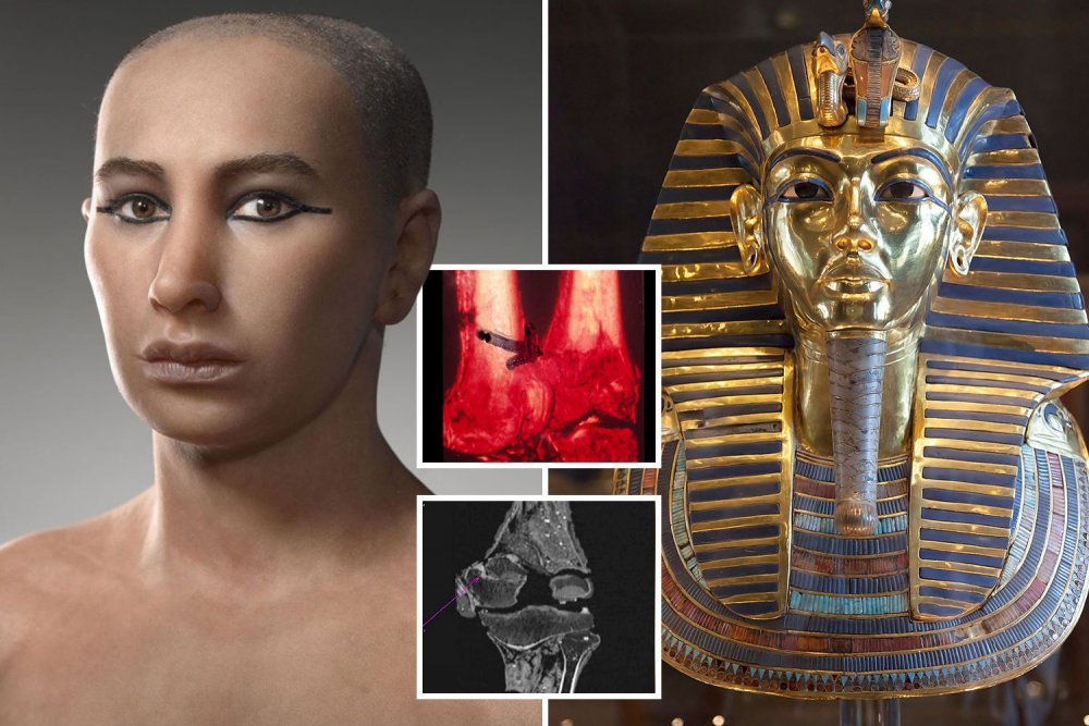 Мумия царя Тутанхамона