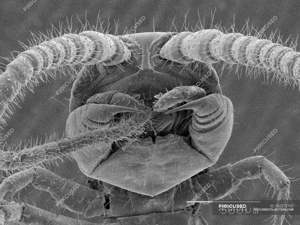 Сороконожка под микроскопом