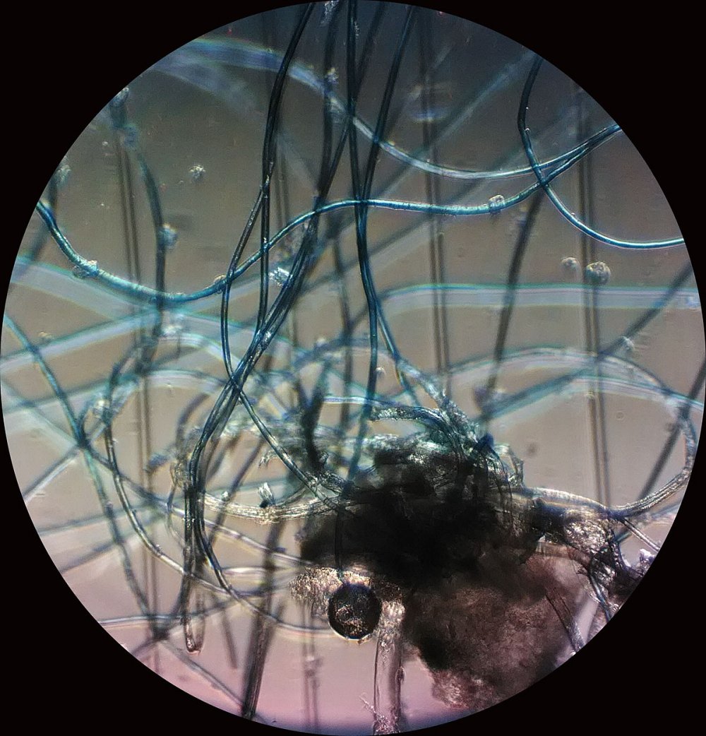 Моллюски под микроскопом