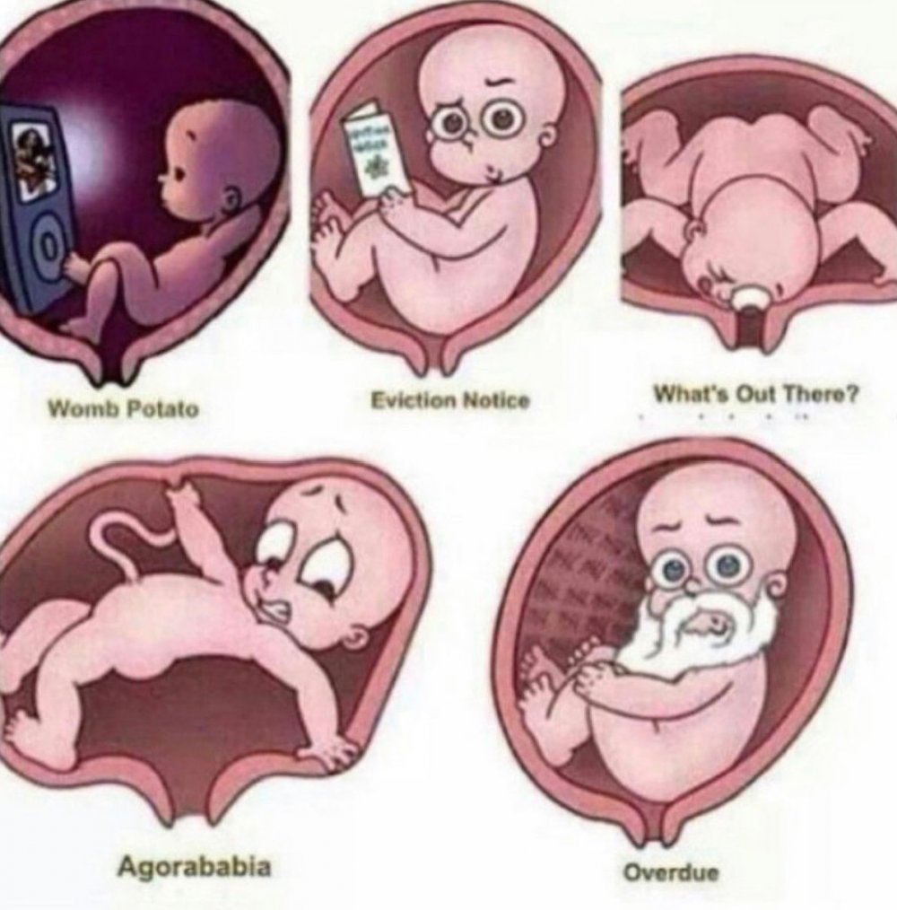 Анекдоты про беременных