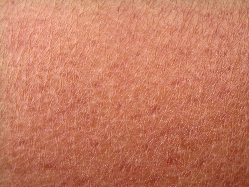 Текстура человеческой кожи 4к