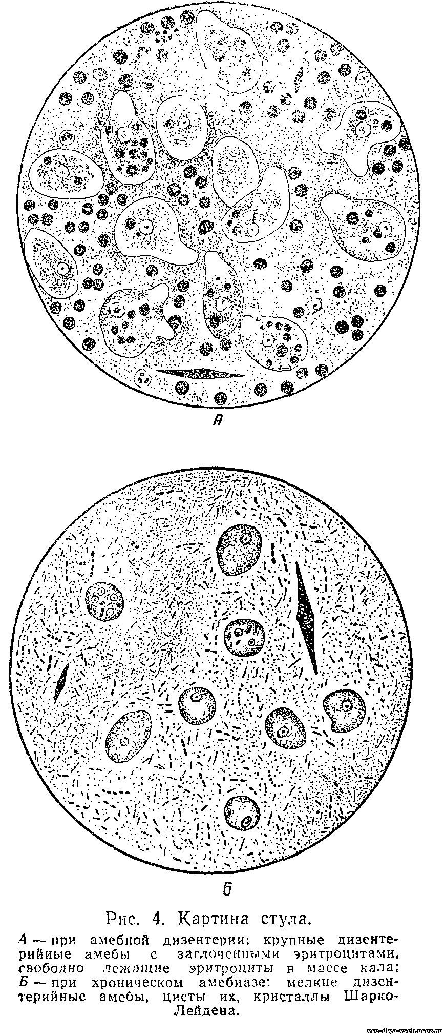 Дизентерийная амеба рисунок
