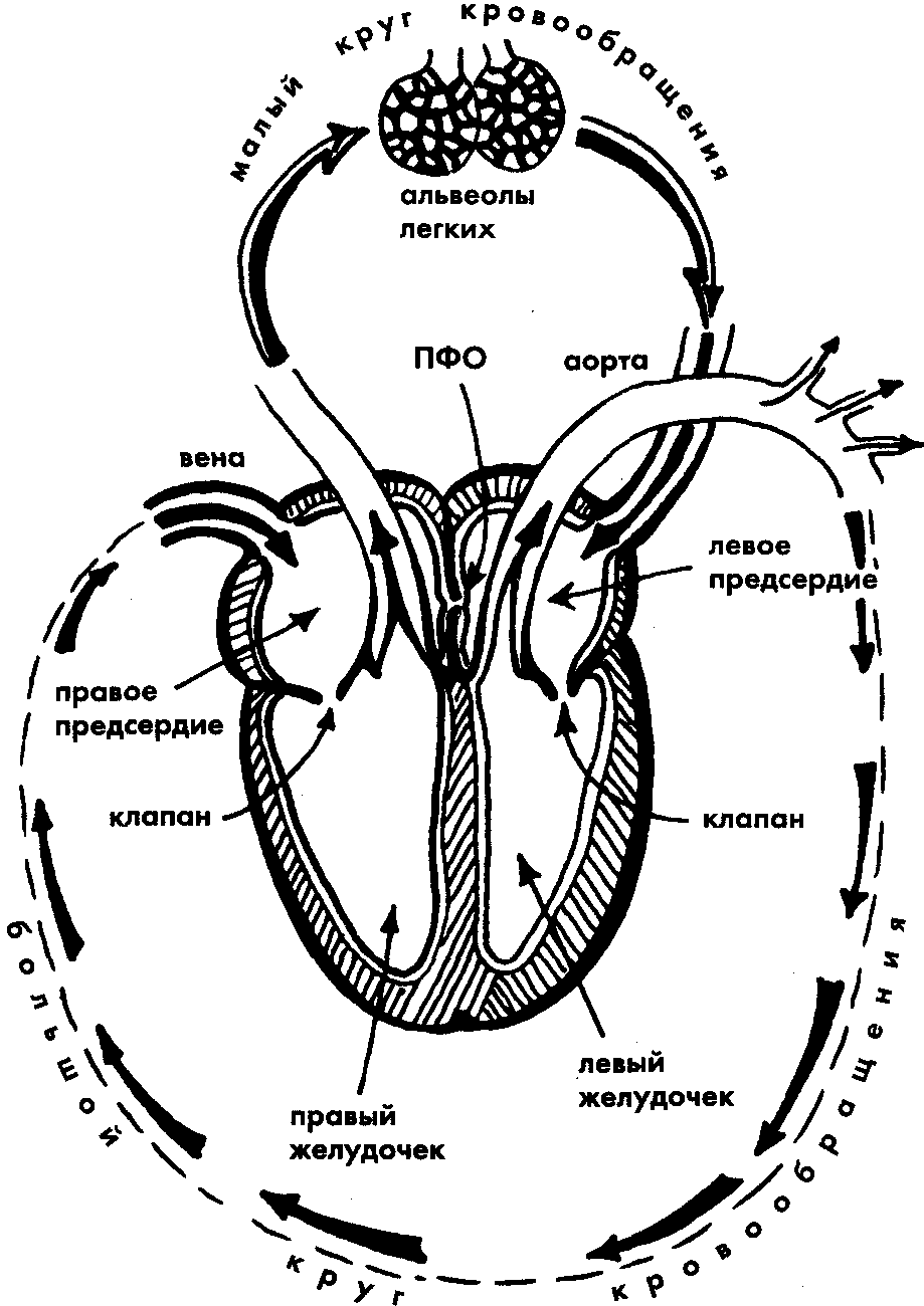 Схема эмболии большого и малого кругов кровообращения