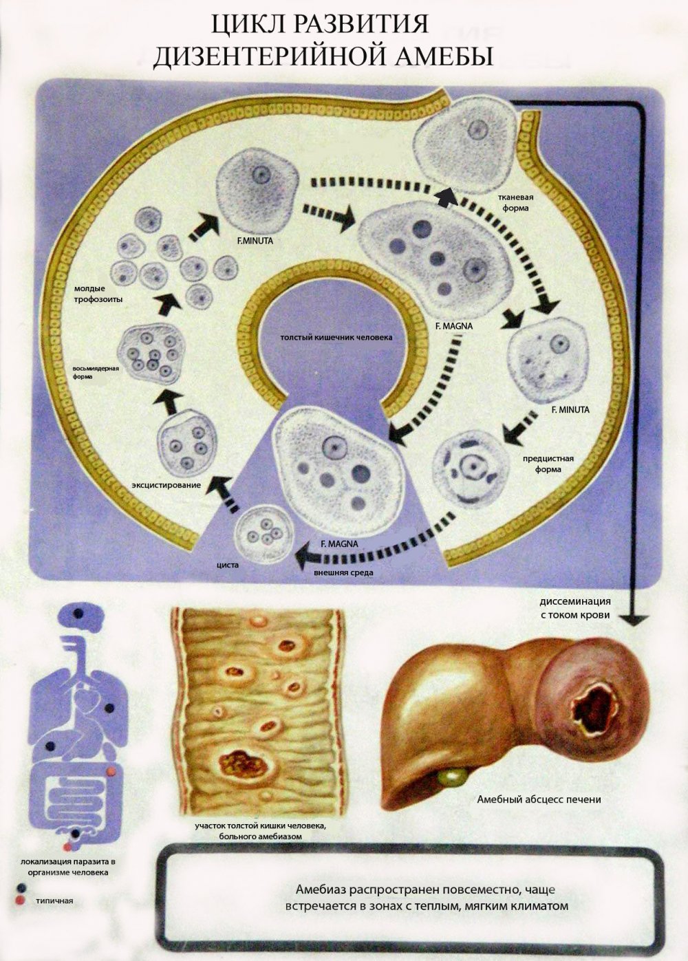 Жизненный цикл дизентерийной амебы Entamoeba histolytica