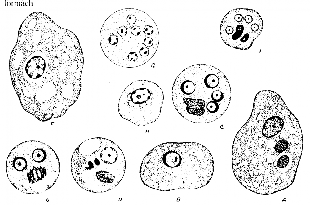 Entamoeba histolytica