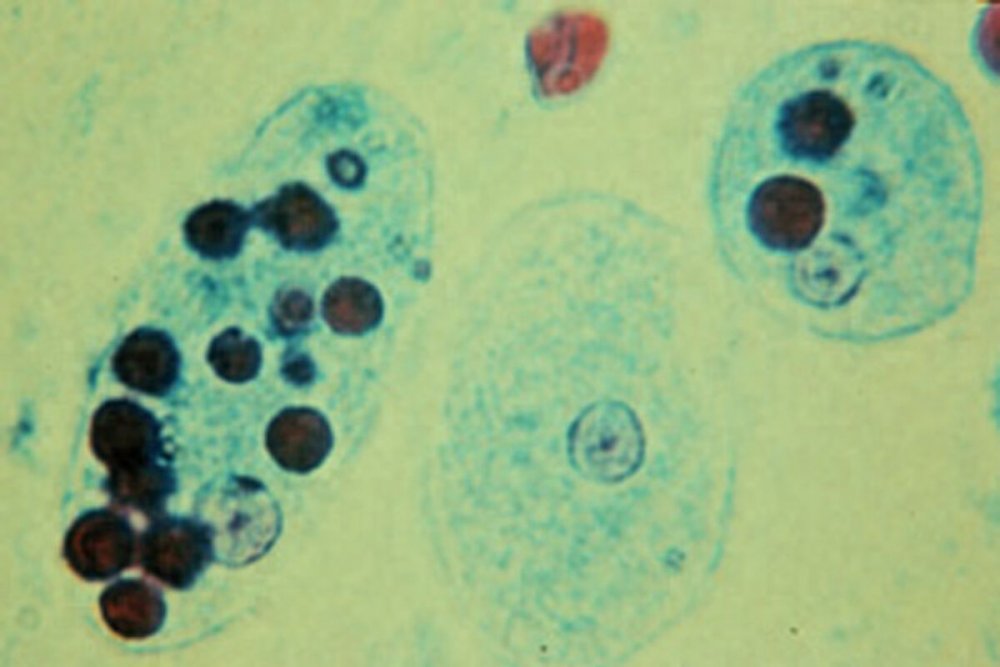 Entamoeba histolytica трофозоит