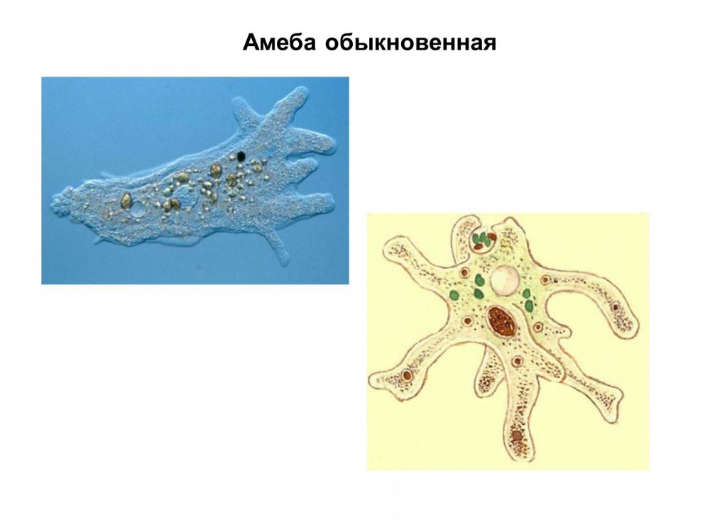 Амеба гребенчатая